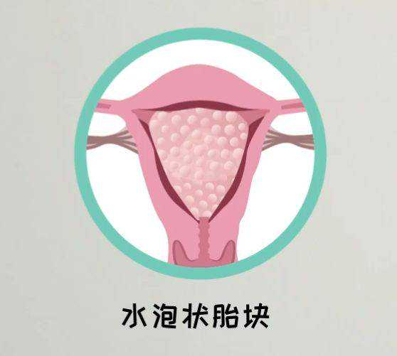 北京供卵代孕公司-北京协和医院：最好的做代孕医院